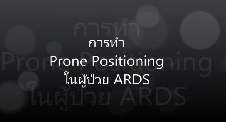 Read more about the article วิดีทัศน์ วิธีจัดท่าคว่ำให้ผู้ป่วย Covid